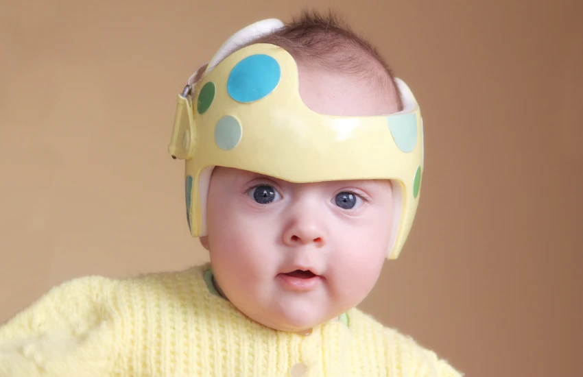 Cabeça achatada em bebê: até quantos ...