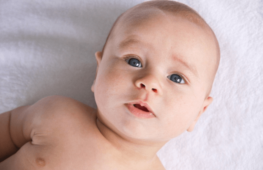 Torcicolo e Assimetria Craniana